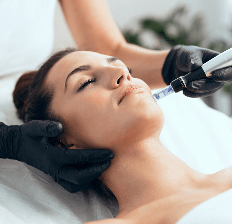 Facial treatment with microneedling device
