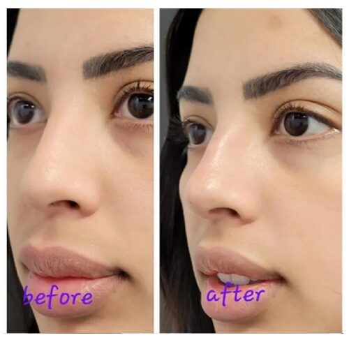 Before and after cosmetic treatment